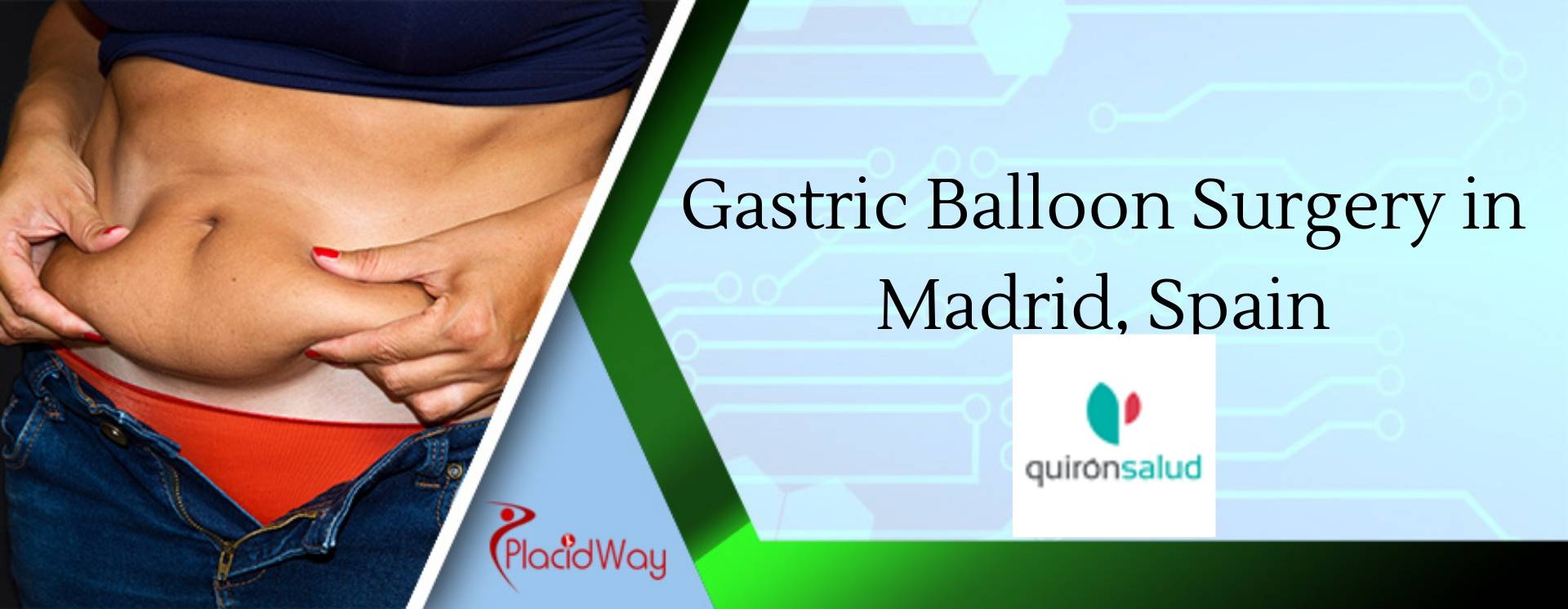 Gastric Balloon Surgery in Madrid, Spain